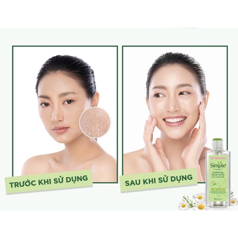 Nước Hoa Hồng Simple Dành Cho Da Nhạy Cảm Kind to Skin Soothing Facial Toner 200ml