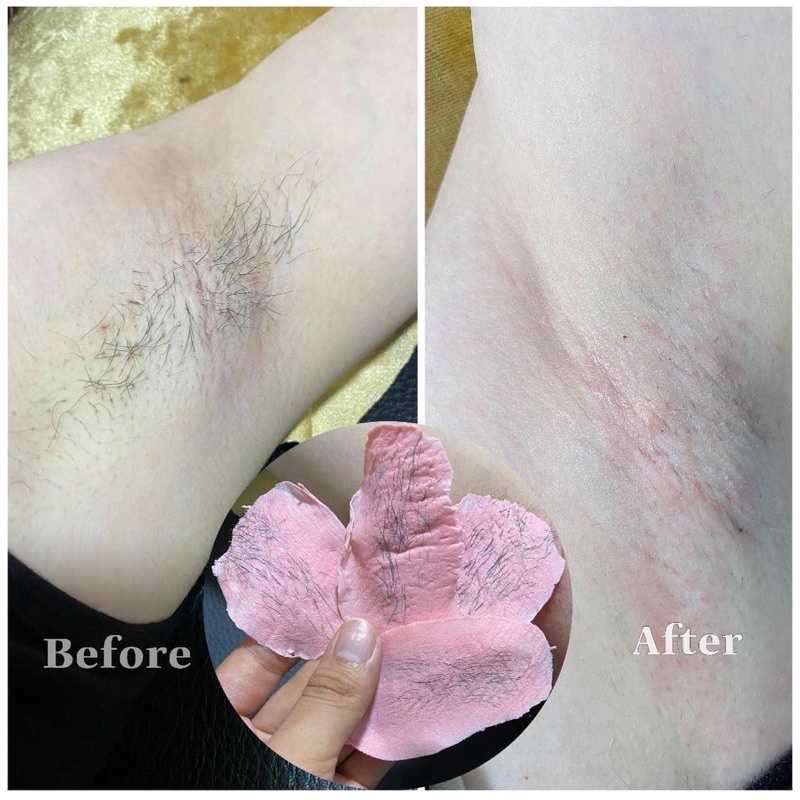 COMBO WAXING NỒI CHỐNG DÍNH CERAMIC