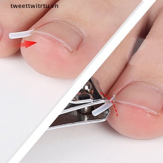 TRWITU 10pcs Toenail Straightening Clip Ingrown Toenail Correction Nail thumbnail