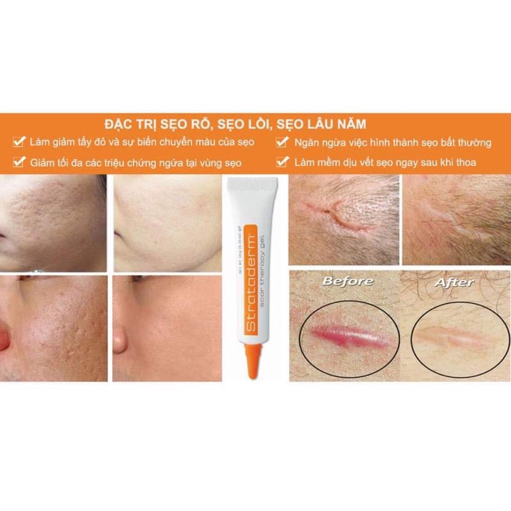 Strataderm chính hãng - Gel xóa mờ sẹo vừa, sẹo lồi, sẹo thâm, sẹo rỗ