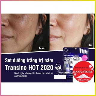 BỘ,SET TRANSINO MINI 5 MÓN NHẬT BẢN.