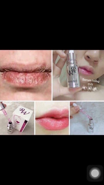 PINK SERUM: LÀM HỒNG MÔI – HỒNG NHŨ HOA – VÙNG KÍN