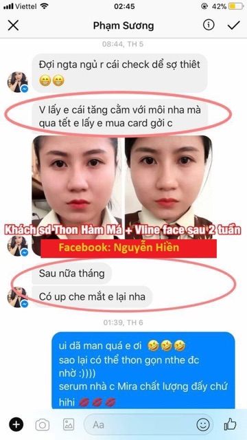 Tinh Chất Thu xương Vline Face Hàn