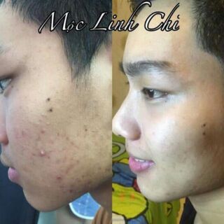 Thảo dược Mộc Linh Chi
