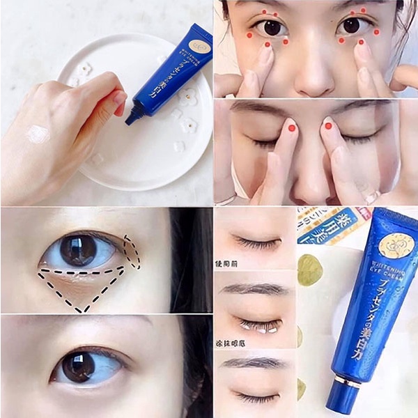 Kem mắt Meishoku Whitening Eye Cream