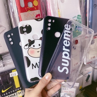 Ốp lưng , Kính cường lực Vsmart active 3 full keo 21d, ốp dẻo đen, trong suốt