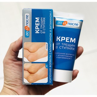 KEM THOA GIẢM NỨT GÓT CHÂN KPEM - 50ML - HÀNG NGA