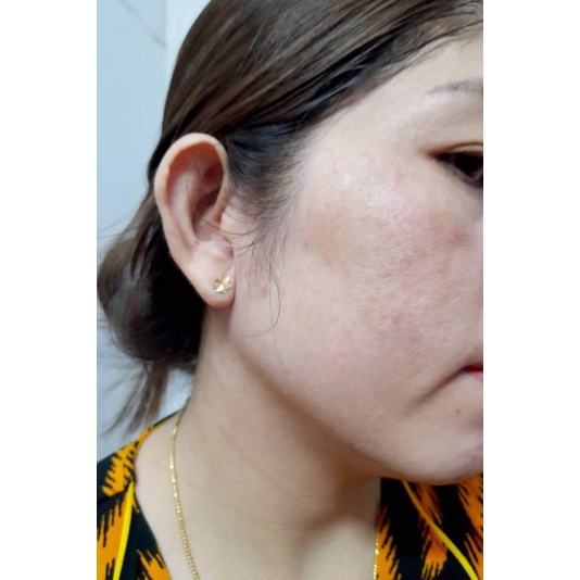 Kem Face nám tàn nhang da không đều màu