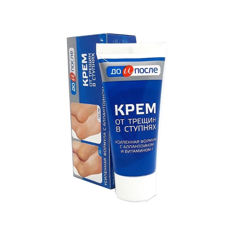 Kem giảm nứt nẻ gót chân Kpem Apteka của Nga 50ml Date mới