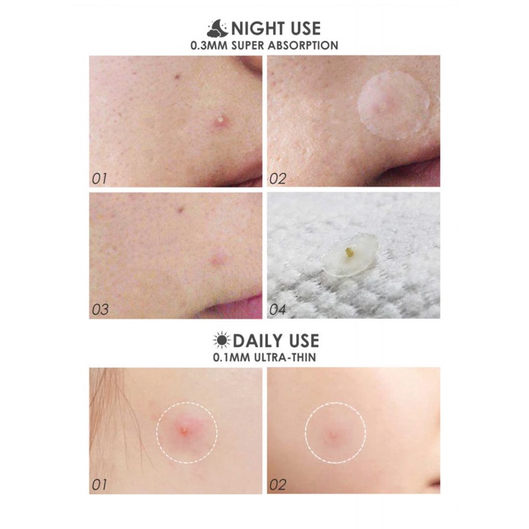 Bộ 24 miếng dán mụn chiết xuất tràm trà sử dụng ban ngày và ban đêm Focallure | BigBuy360 - bigbuy360.vn