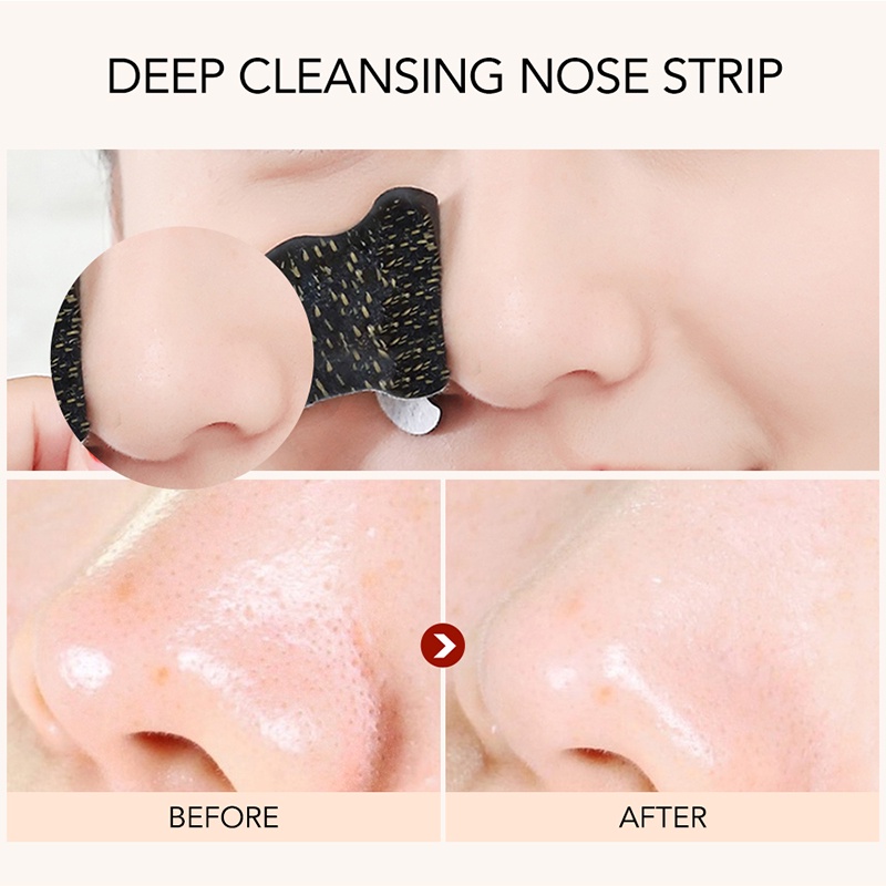 Miếng dán mũi lột mụn đầu đen làm sạch sâu lỗ chân lông
