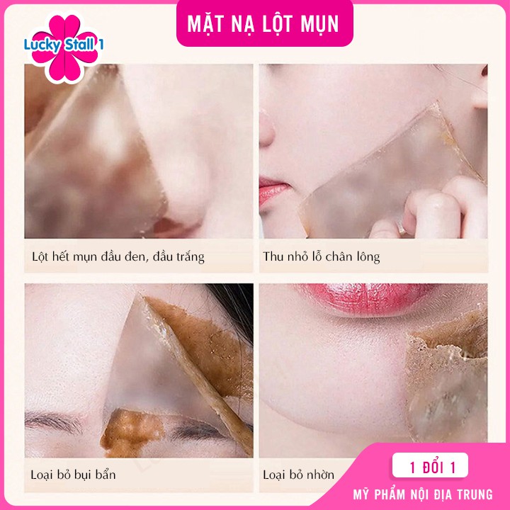 Mặt Nạ Lột Mụn Ying-Z-Se - Nạ lột Mụn Đầu Đen, Mụn Ẩn, Sáng Da Dưỡng Ẩm Se Khít lỗ chân lông