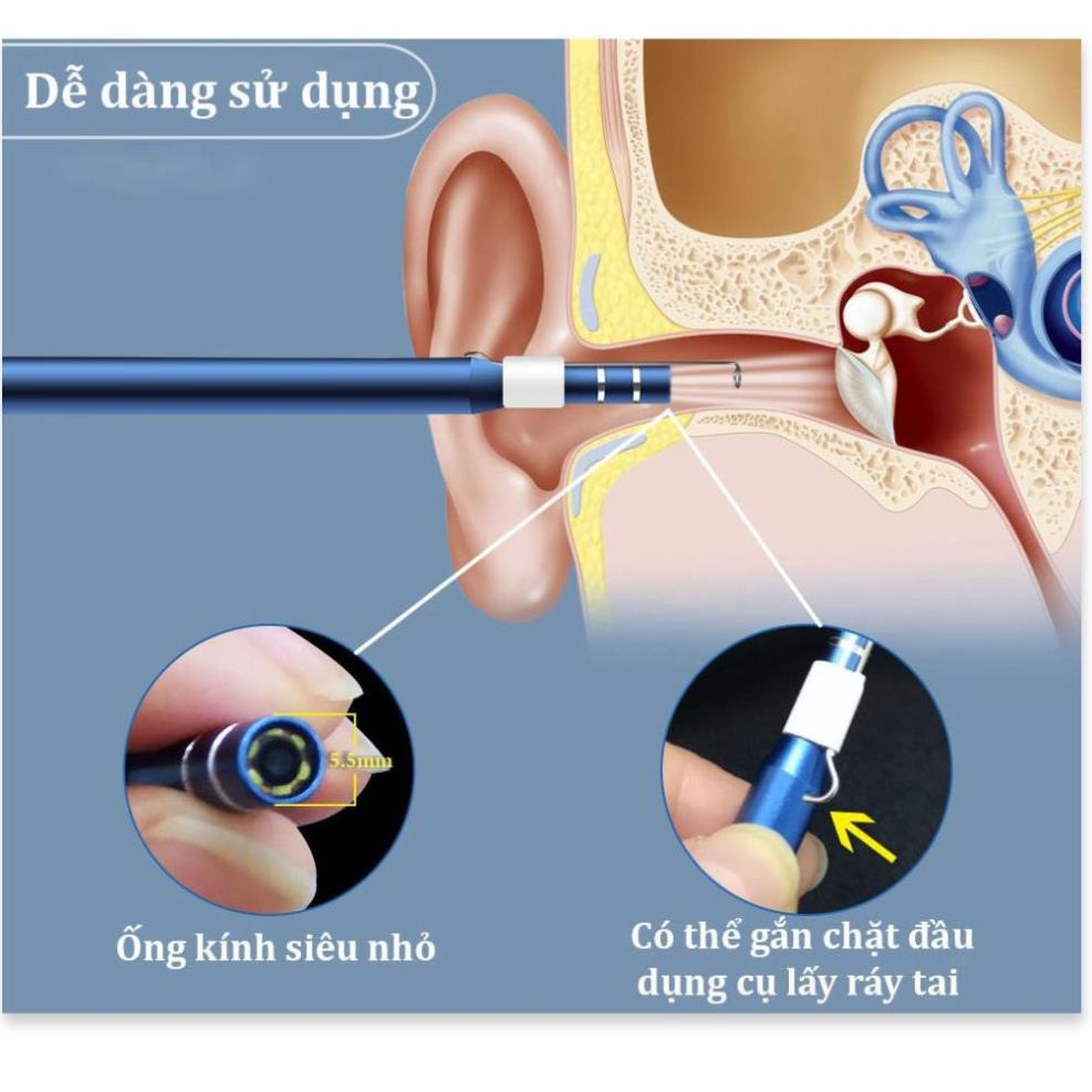 (GIÁ SỐC) Hút Ráy Tai camera 3 trong 1,Nội Soi Tai Mũi Họng, Có Kết Nối Với Điện Thoại, Máy Tính