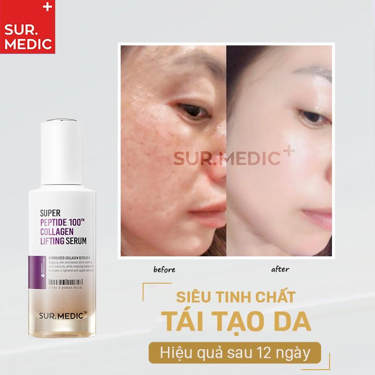 Tinh Chất Tái Tạo Phục Hồi Da Săn Chắc Sur.Medic Super Peptide Collagen Lifting Serum 50ml