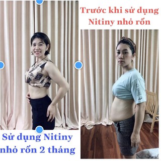 Tinh chất nhỏ rốn Nitiny