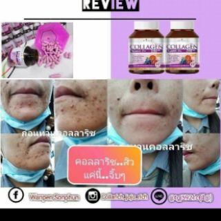 viên uống collagen 596mg