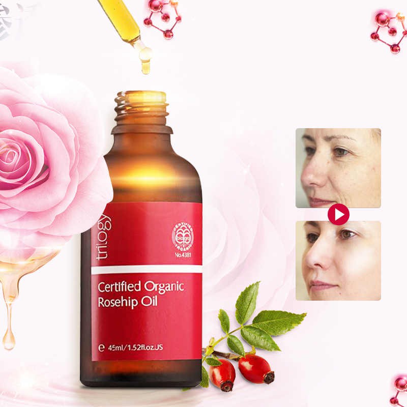 Trilogy Tinh Dầu Tầm Xuân Certified Organic Rosehip Oil 45ml