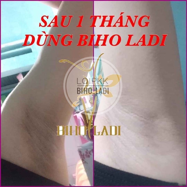 BIHO LADI 5S - SIÊU DƯỠNG THÂM 5S