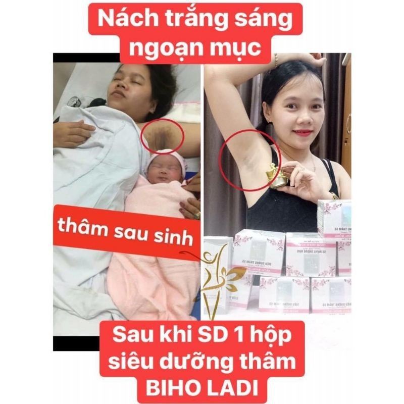 BIHO LADI 5S - Siêu Dưỡng Thâm 5s Đánh Bay Thâm Nách, Mông, Bikini, BIHO LADY