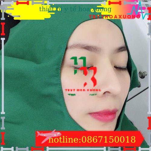 Săng Mổ Vải 2 Lớp Có Lỗ Và Không Lỗ Kích Thước 90x90 cm