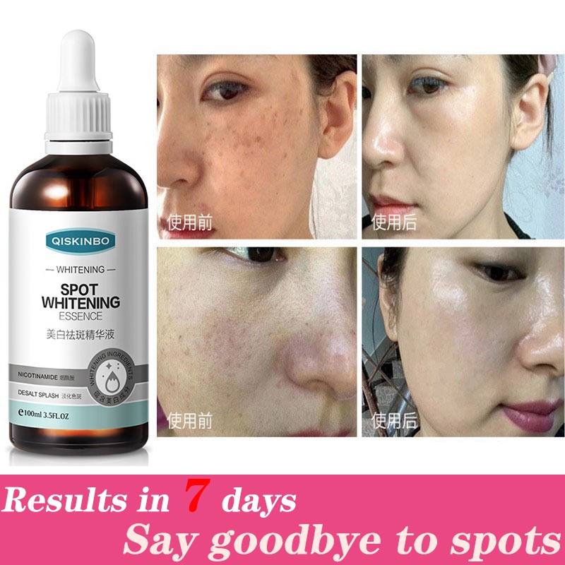 100ml kem dưỡng trắng da và loại bỏ tàn nhang - loại bỏ tinh chất làm sáng và giảm đốm niacinamide Dung dịch gốc chứa niacinamide dưỡng ẩm, làm dịu và phục hồi da mặt