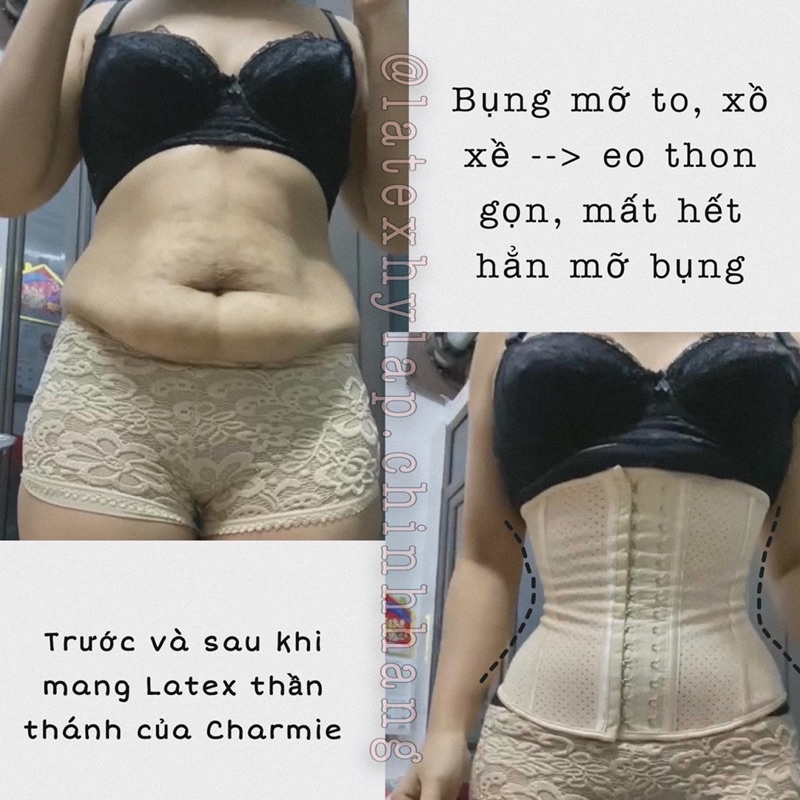 Đai nịt bụng Latex thông hơi 25 xương - Summer Latex by Charmie | BigBuy360 - bigbuy360.vn