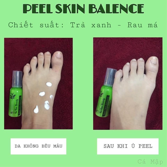 PeeL Skin Ủ Trắng Mặt Và Body | BigBuy360 - bigbuy360.vn