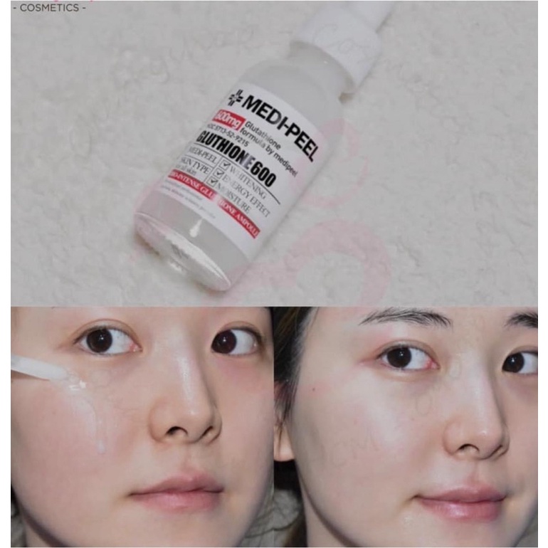 Serum Truyền Trắng Medipeel Glutathione 600 30ml Se Khít Lỗ Chân Lông
