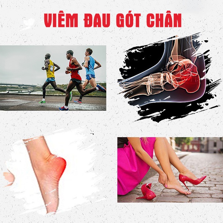 Cao dán viêm cân gan chân - Viêm gót chân | BigBuy360 - bigbuy360.vn