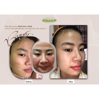 30ml serum Thanh Dược Lare