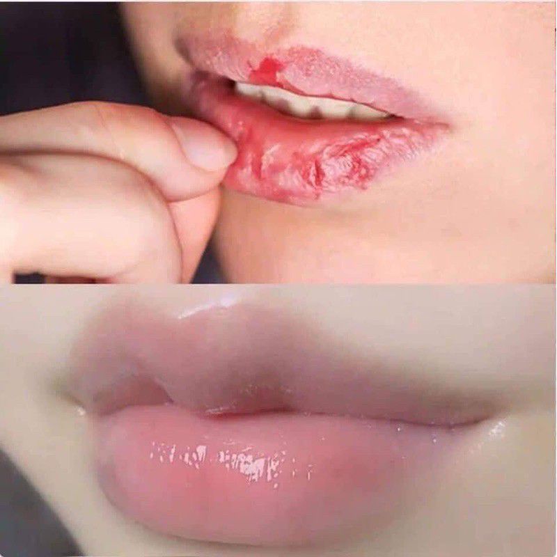 Son dưỡng môi thái lan Lips Care 2g