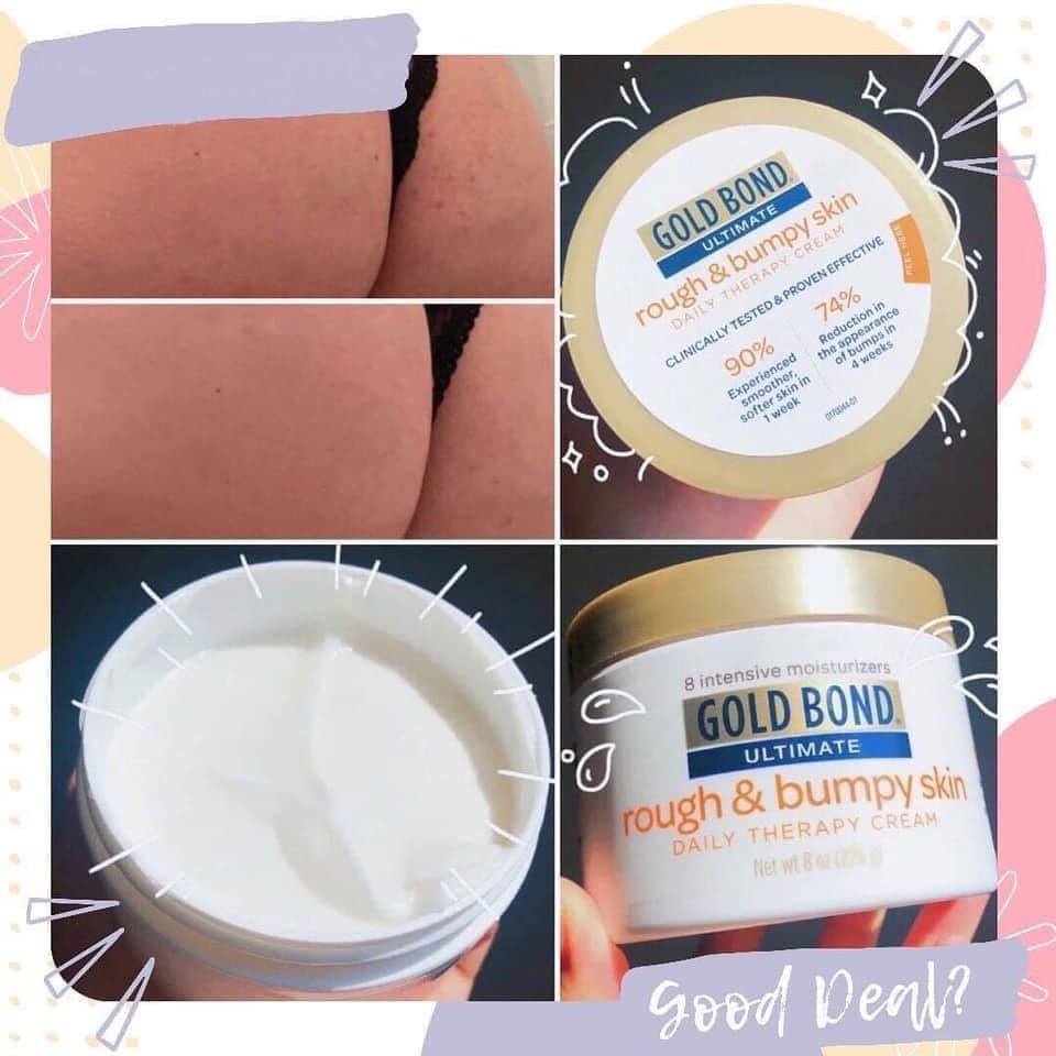 Kem dưỡng Body Gold Bond Rough and Bumpy Skin 226gr | BigBuy360 - bigbuy360.vn