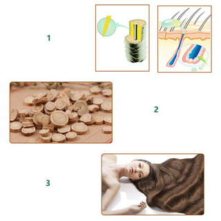 Tinh Chất Gừng Kích Thích Mọc Tóc Cho Nam Và Nữ
