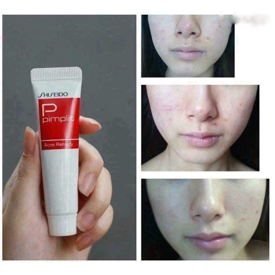 Kem giảm mụn Shiseido Pimplit