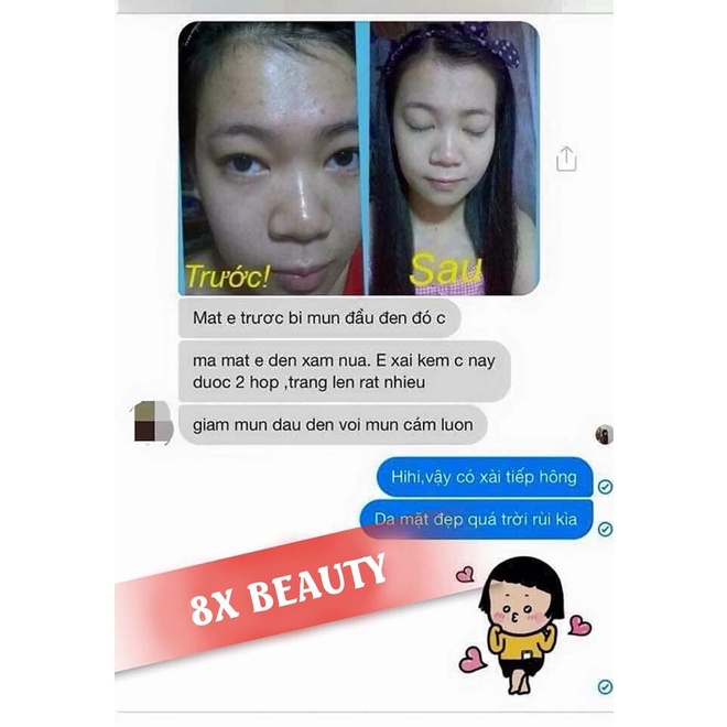 KEM HOA MẤU ĐƠN 8X BEAUTY VÀ SERUM ALPHA BURTIN ĐÁNH BAY NÁM  TÀN NHANG DƯỠNG DA TRẮNG SÁNG VÀ MỊN MÀNG SAVASA BO02