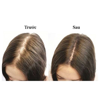 TINH DẦU BƯỞI TRỊ RỤNG TÓC HOA NÉN