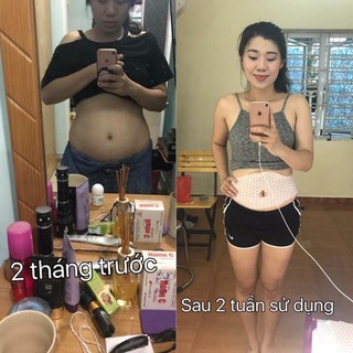 Miếng Dán Tan Mỡ Bụng Spa Gel Patch 42°C Hàn Quốc
