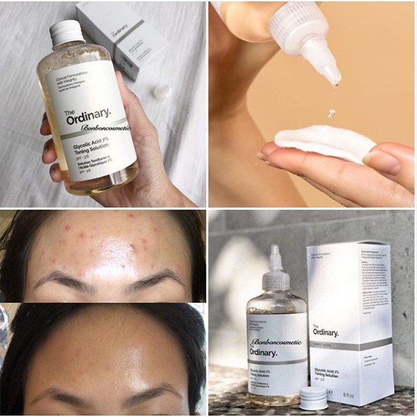 Nước hoa hồng tẩy da chết AHA The Ordinary Glycolic Acid 7% Toning Solution