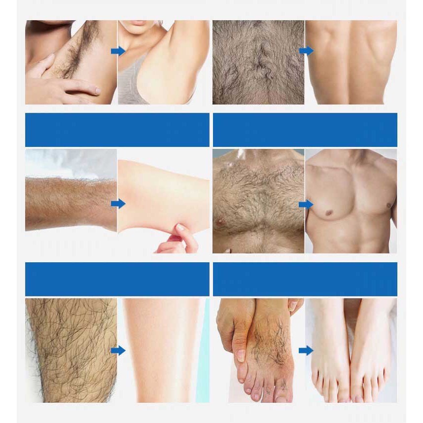 Kem Tẩy Lông Nách, Chân Tay, Vùng Kín, Tái Tạo Làn Da KOOGIS Cho Nam Nữ Nhẹ Dịu, An Toàn Và Hiệu Quả | BigBuy360 - bigbuy360.vn