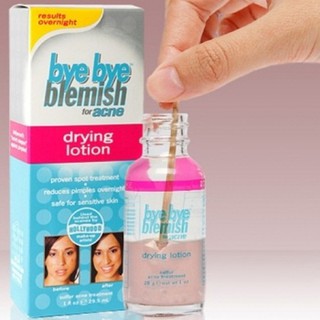 Chấm mụn Bye Bye Blemish Drying Lotion