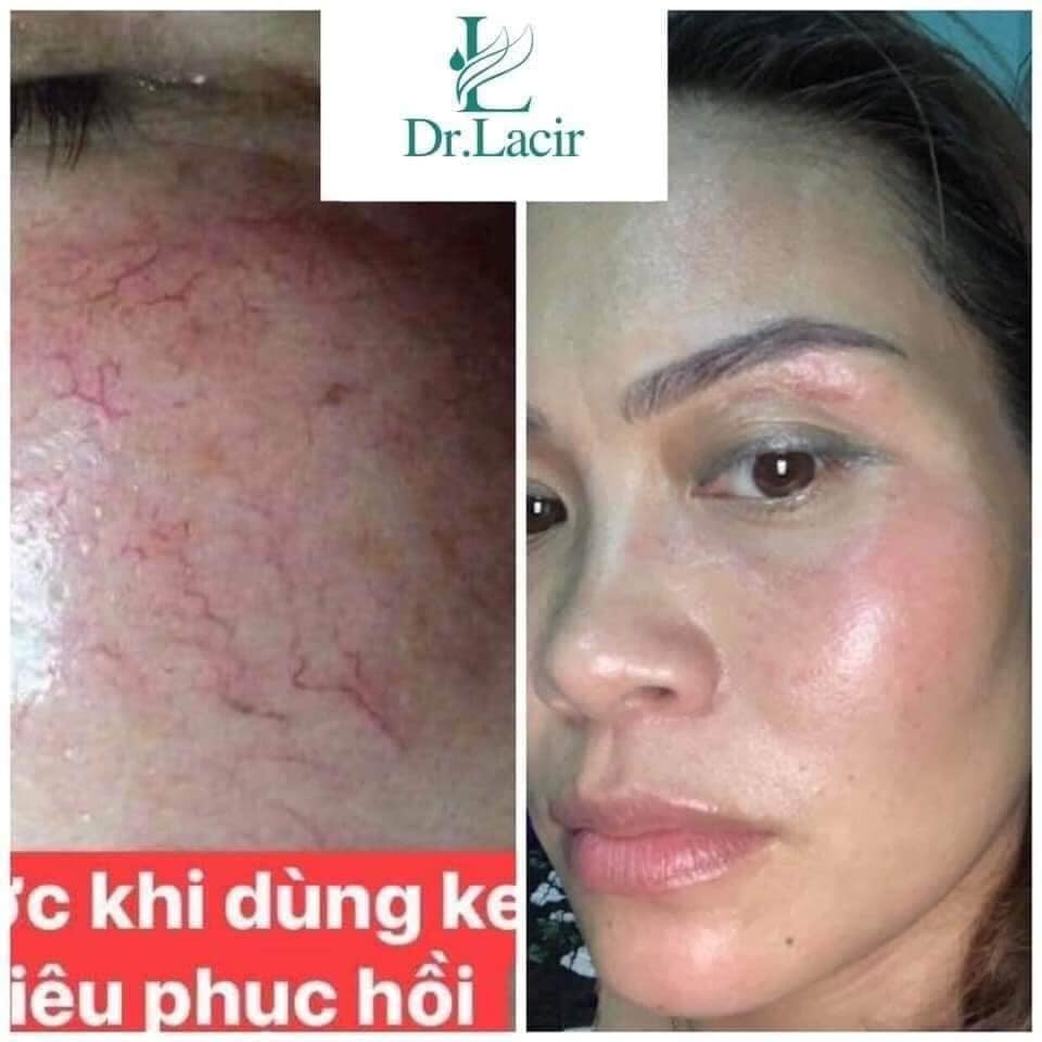 Kem phục hồi da Lamer Dr Lacir