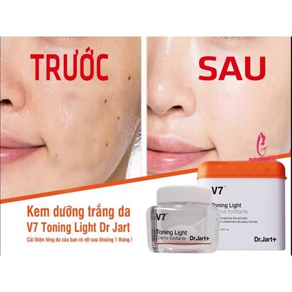 Kem dưỡng trắng phục hồi da bị hư tổn sạm nám thâm V7 TONING LIGHT Hàn Quốc [MẪU MỚI]