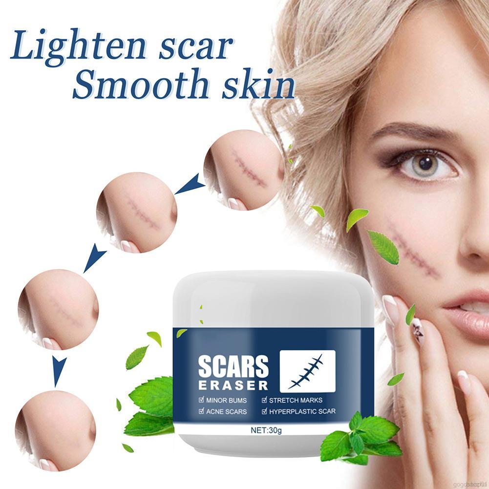 Multi-effect Scar Acne Cream Pimple Treatment Cream Scar Removal Cream- Stretch Marks Remover Cream For All Skin Types, New And