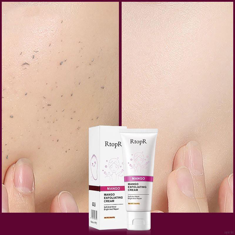 (Hàng Mới Về) Gel Tẩy Tế Bào Chết Da Mặt Chiết Xuất Xoài Rtopr Làm Sạch Sâu Và Se Khít Lỗ Chân Lông | BigBuy360 - bigbuy360.vn