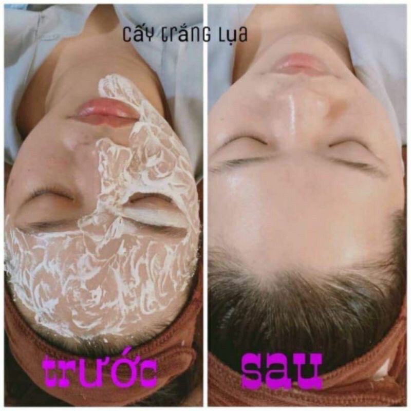 Cấy Trắng Lụa Nano Collagen - Thẩm Mỹ Huyền Trang NANOCEE