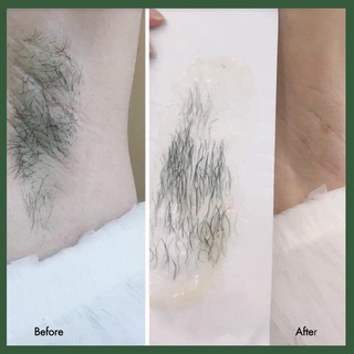 Wax Lông + Mỡ Trăn Triệt Lông An Lành ( Wax+Mỡ trăn+Tinh Dầu Dược Liệu+1Set Giấy và 2Que)