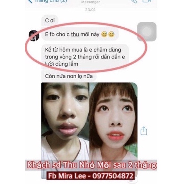 Tinh chất thu nhỏ môi Miracle, hiệu quả chỉ sau 14 ngày