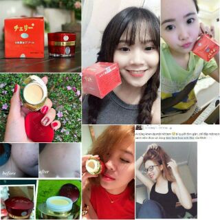 Kem Face Dưỡng Trắng Da Hoa Anh Đào