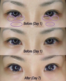 Kem mắt nâu estee lauder