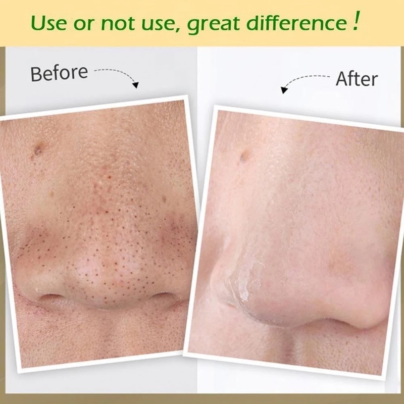 Mặt Nạ Bùn Khoáng Lột Mụn Đầu Đen Cho Mọi Loại Da / Làm Sạch Sâu